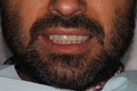 Case03-Before