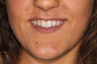 Case05-Before