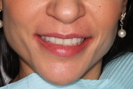 Case06-Before
