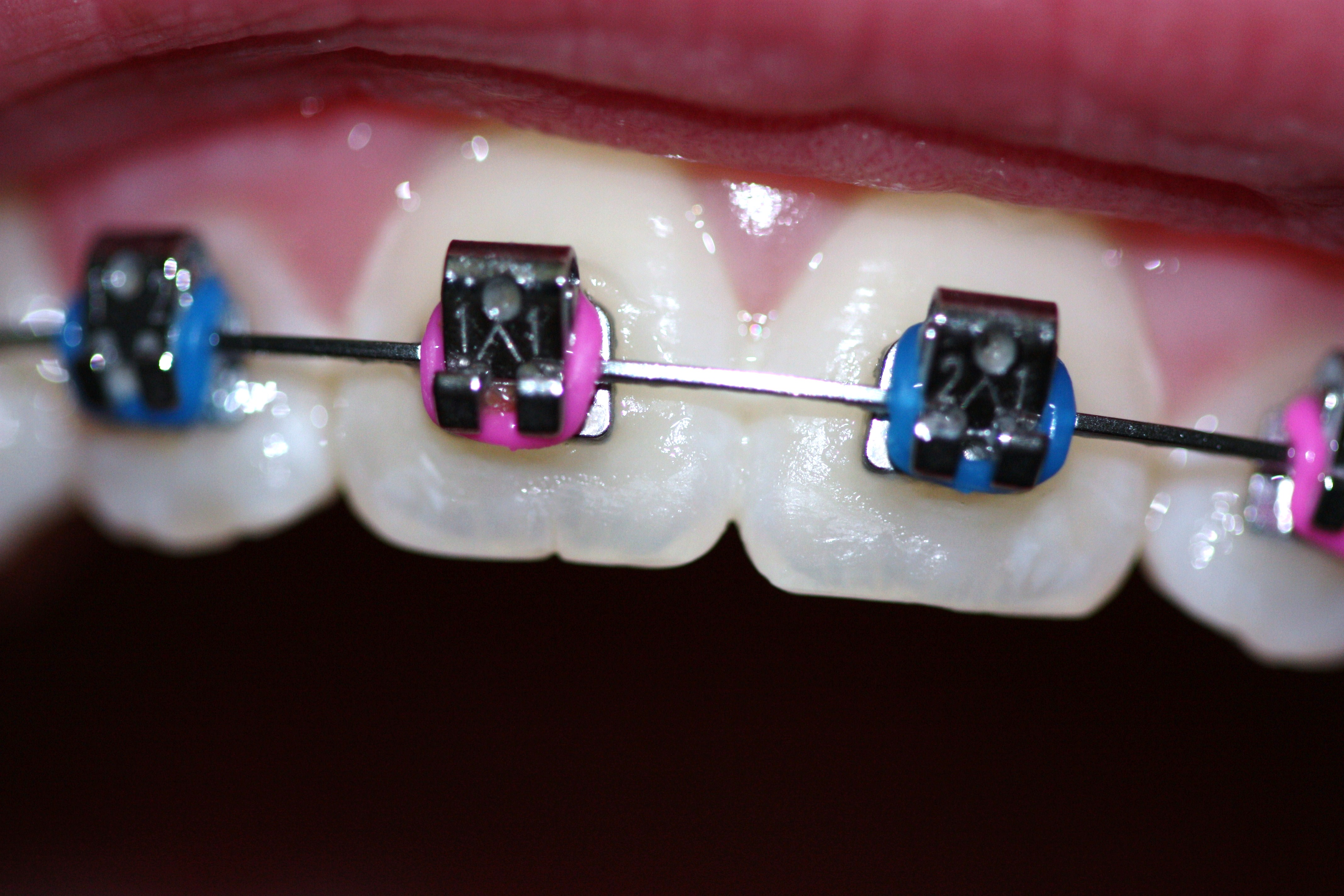 Famous Orthodontist in Canberra Dentist Canberra