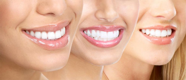 We are the experts of cosmetic and restorative dentistry in Canberra.