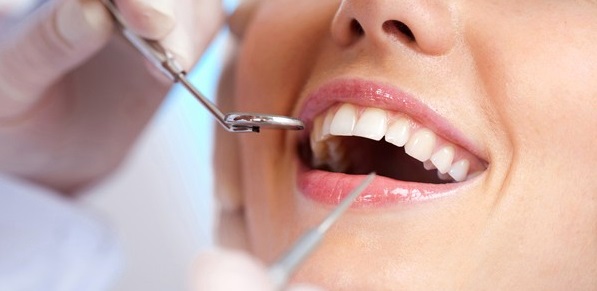 We have the best dental implants in Canberra.