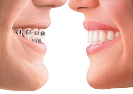 We are the best orthodontics in Canberra.