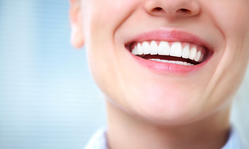 We have the best teeth whitening service in Canberra.