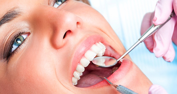 Dental Fillings Cost in Sydney