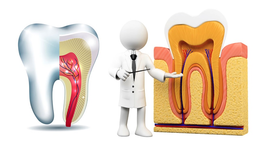 Root canal treatment cost in Canberra