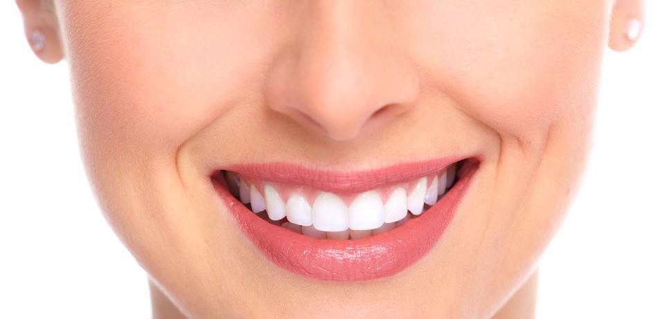 Teeth Whitening for Sensitive Teeth in Canberra