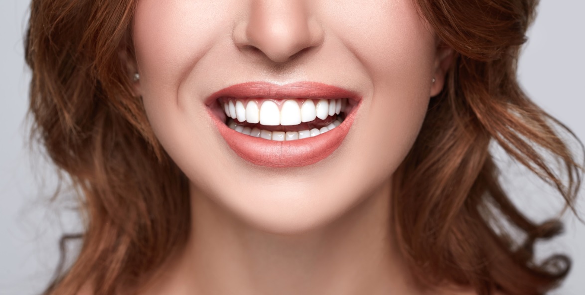 cosmetic dentistry cost in Canberra