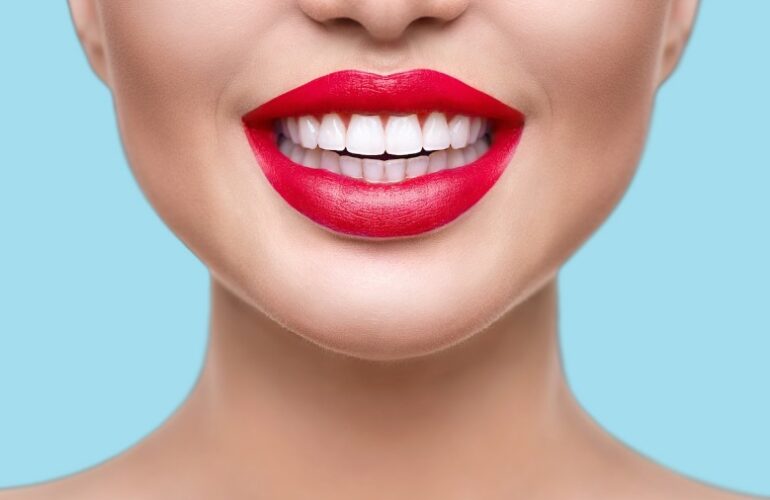 Composite Veneers Cost