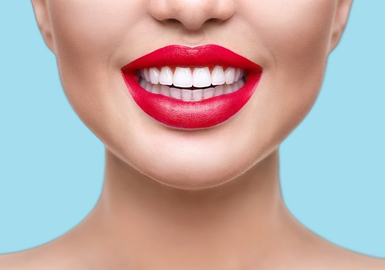 Composite Veneers Cost