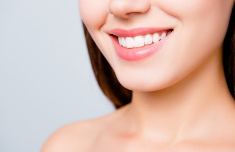 Porcelain Veneers Cost