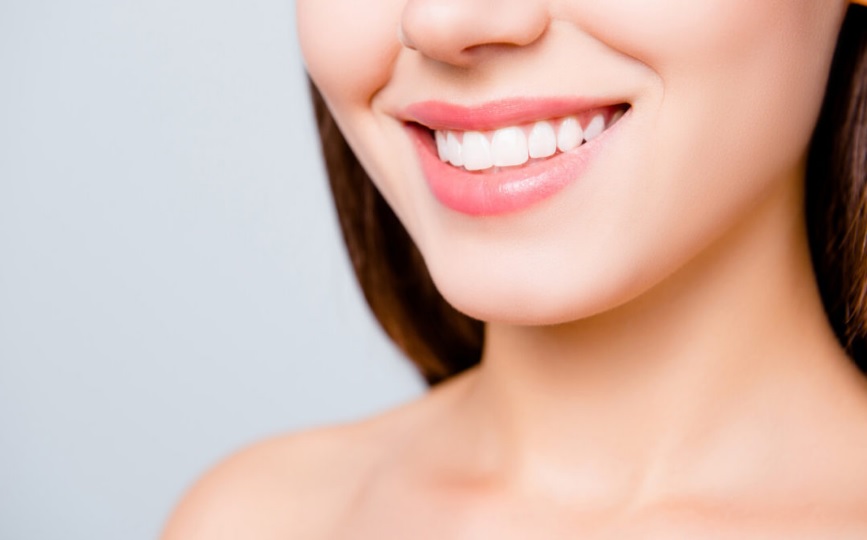 Porcelain Veneers Cost