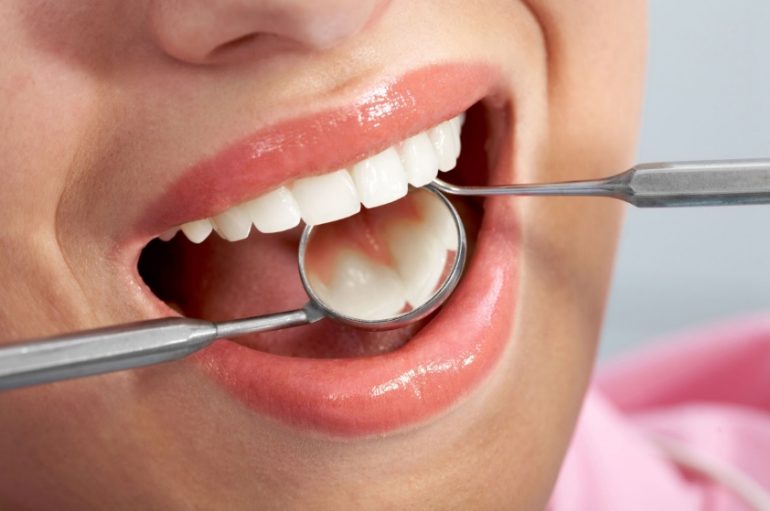 Tooth Filling Cost Civic Gentle Dental Care
