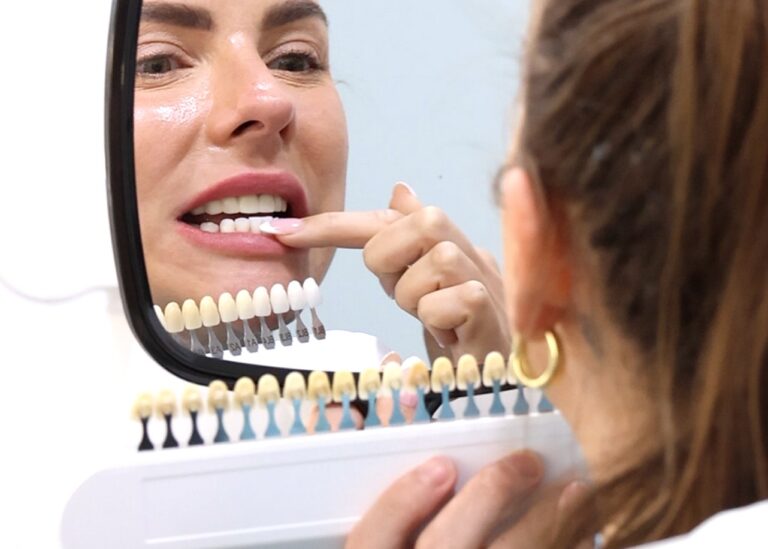 Cosmetic Dentistry in Canberra
